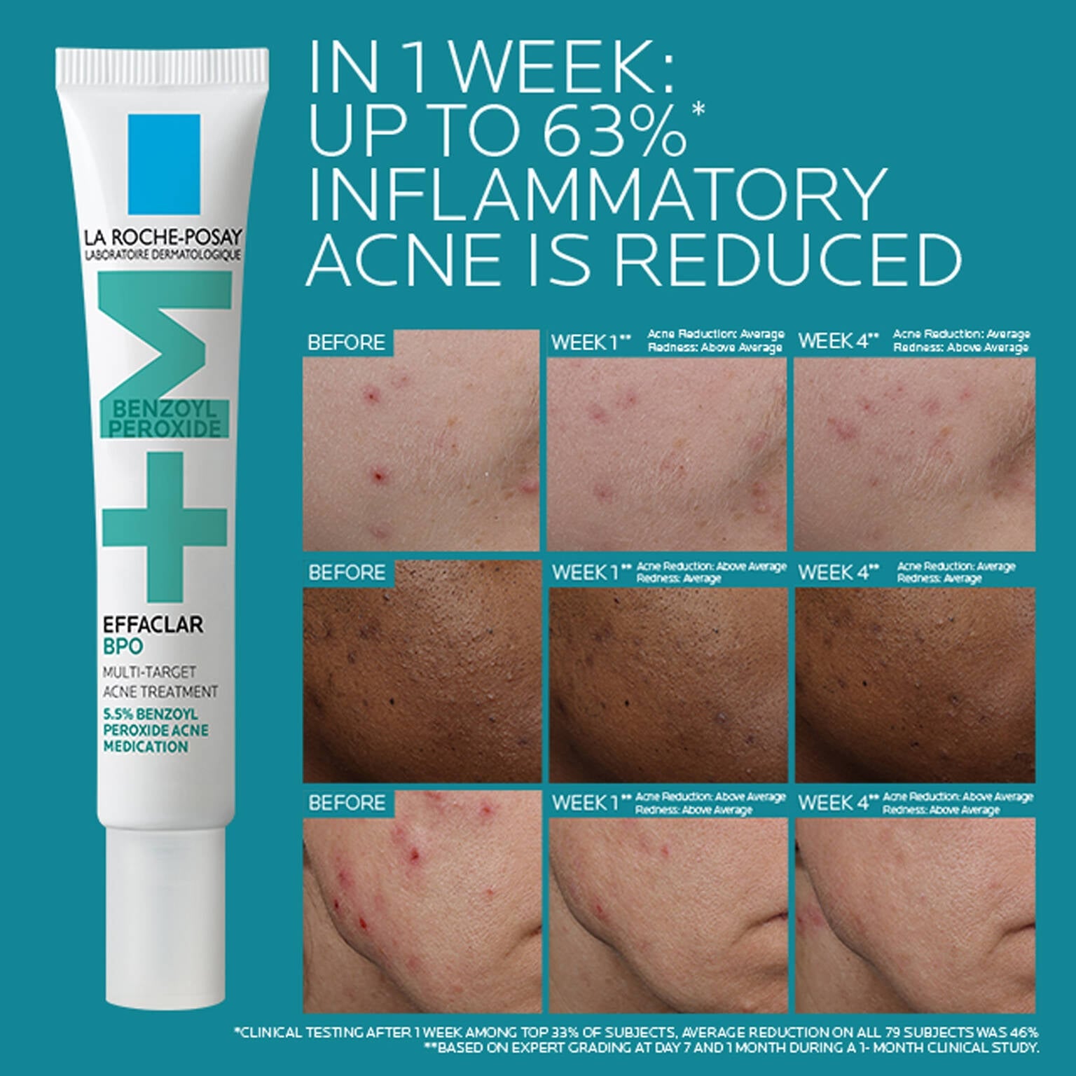 effaclar-bpo-multi-target-acne-treatment-with-5-5-benzoyl-peroxide-j3 EffaclarBPO-ClinicalBA-ATF-1500x1500-2.jpg