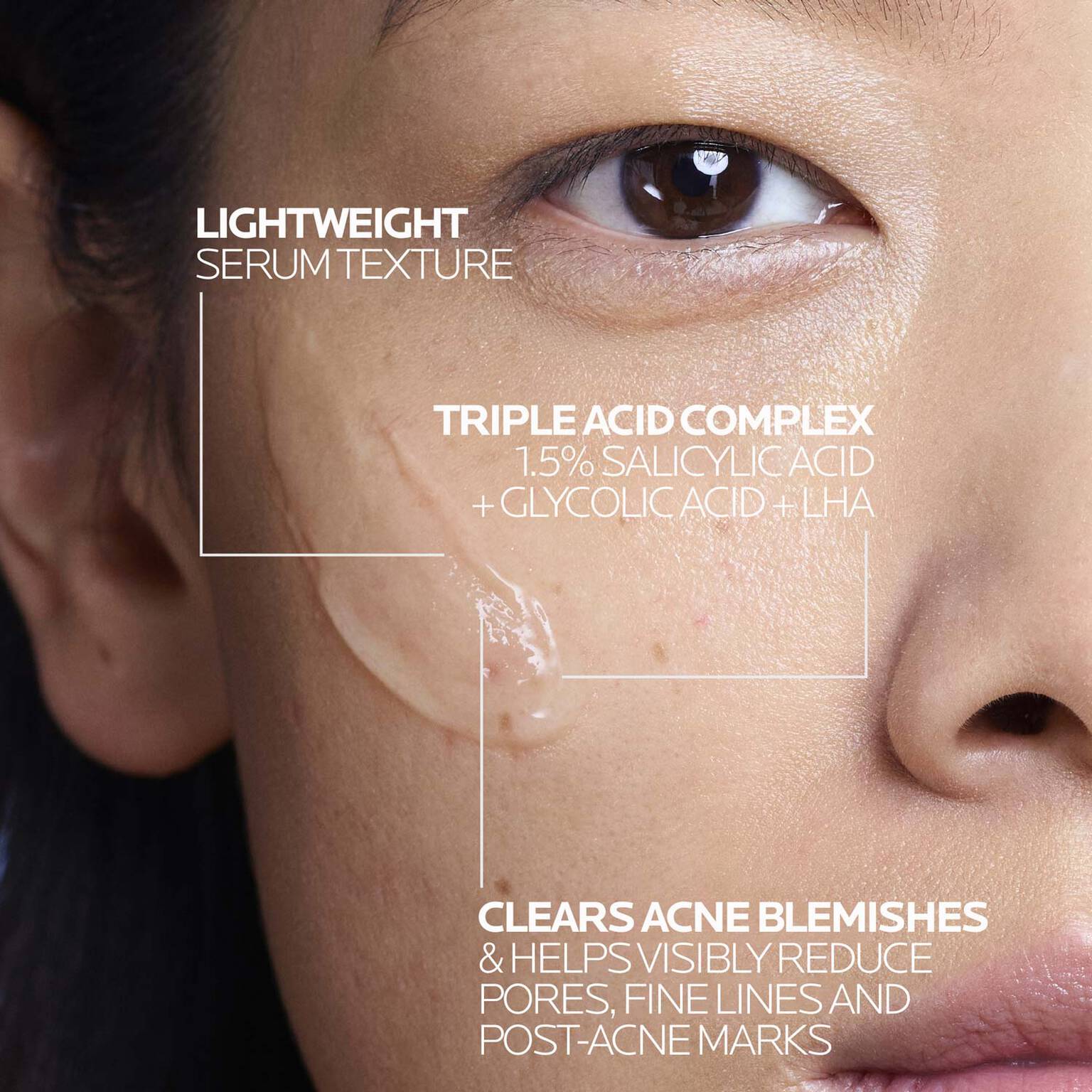 effaclar-salicylic-acid-acne-treatment-serum-b4 LaRochePosay-Product-Effaclar-Effaclar-Serum-30ml-3337875722827-Texture-REV.jpg